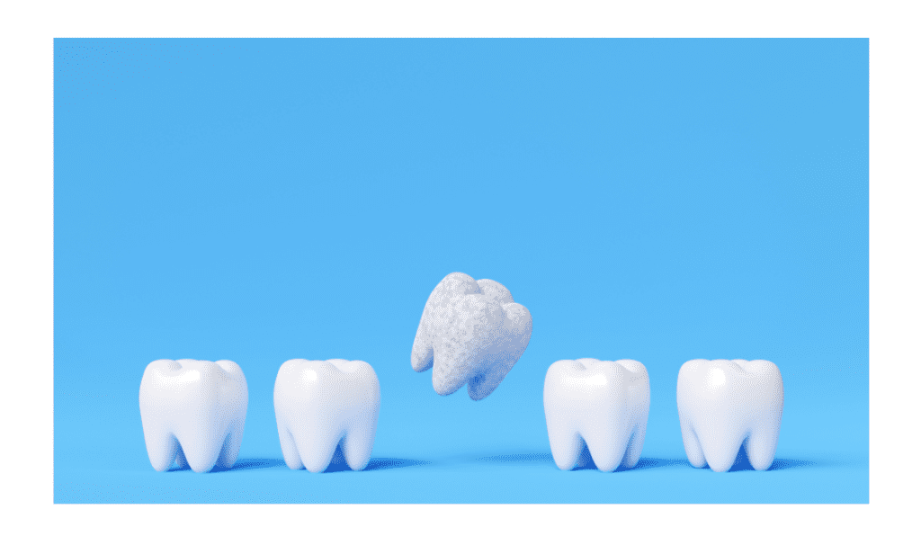 Image-of-four-cute-teeth-healthy-and-free-from-decay-and-cavities-alongside-a-tooth-that-has-been-affected-by-decay-and-cavities-e1720077086472.png