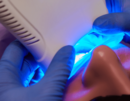 Teeth whitening treatment procedure demonstrating effective results. Learn more about teeth whitening at blog.thealignify.com.